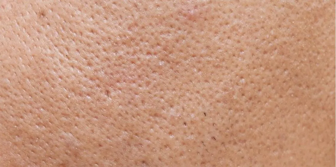 Человеческая кожа. Skin Pores Alpha.